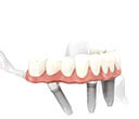 dental_img_1