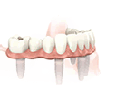 dental_img_2