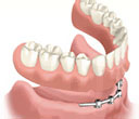 dental_img_3